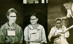 guatemala-syphilis-experiment-victims